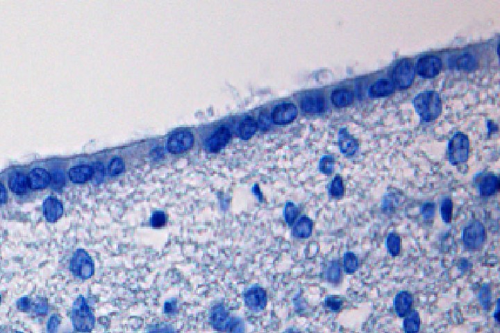 Ependymal cell
